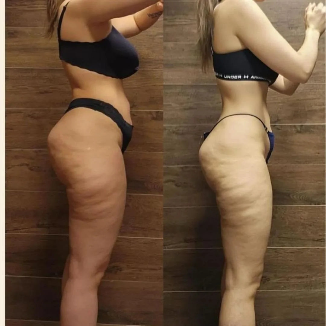Before and after - firmer, lifted skin in 6 weeks